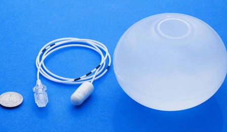 Gastric balloon Belgium