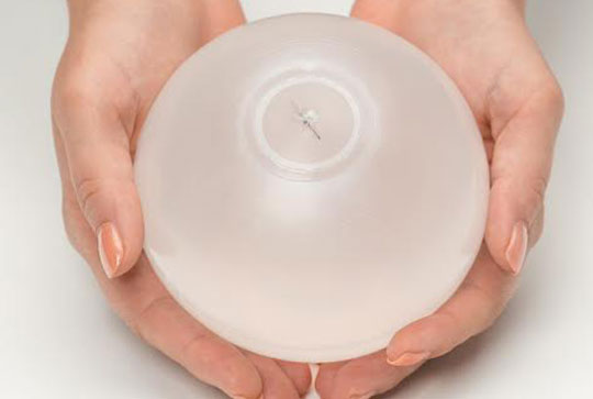 the gastric balloon