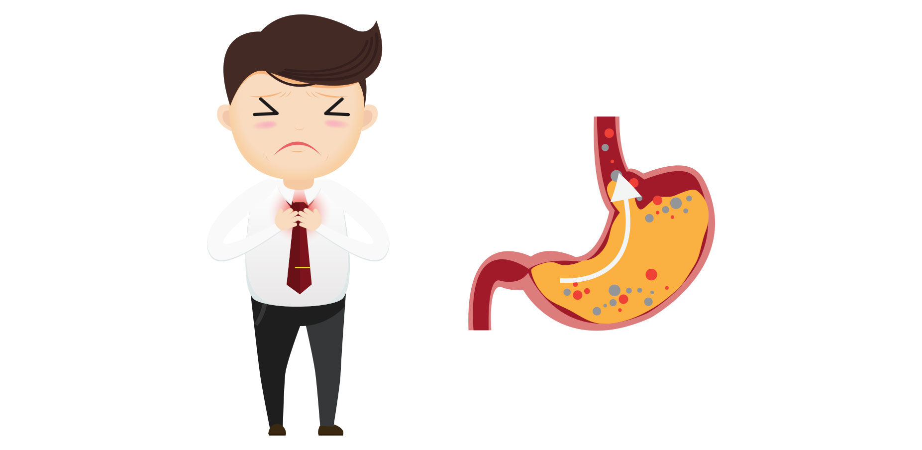 gastro-oesofageale reflux