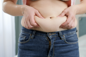 cellulite