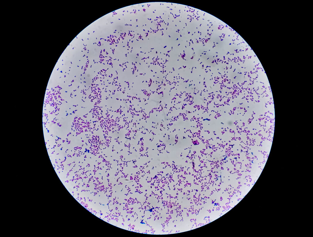 Escherichia coli bactérie gastro