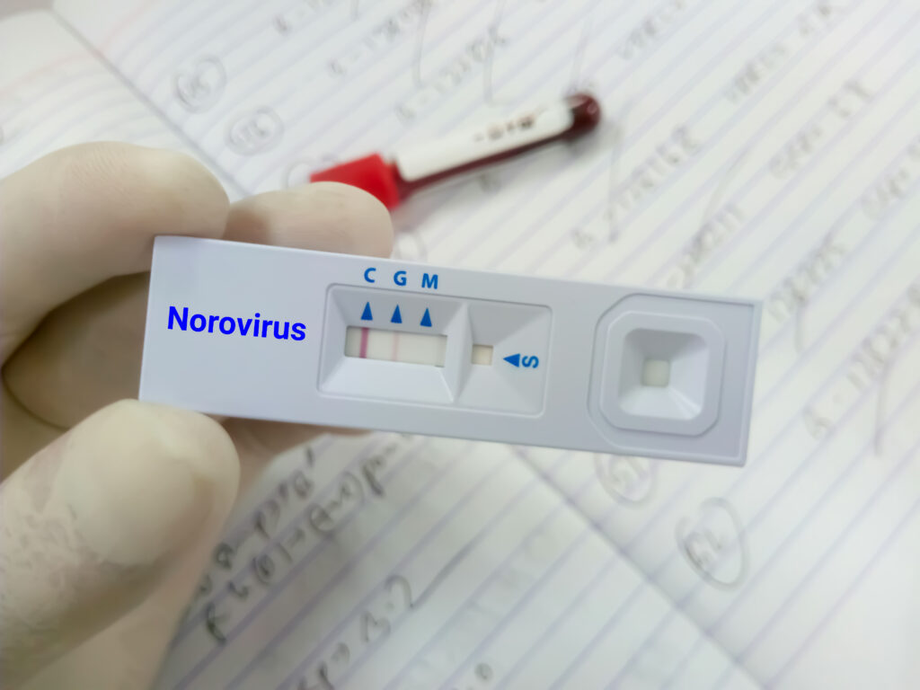 test norovirus gastro