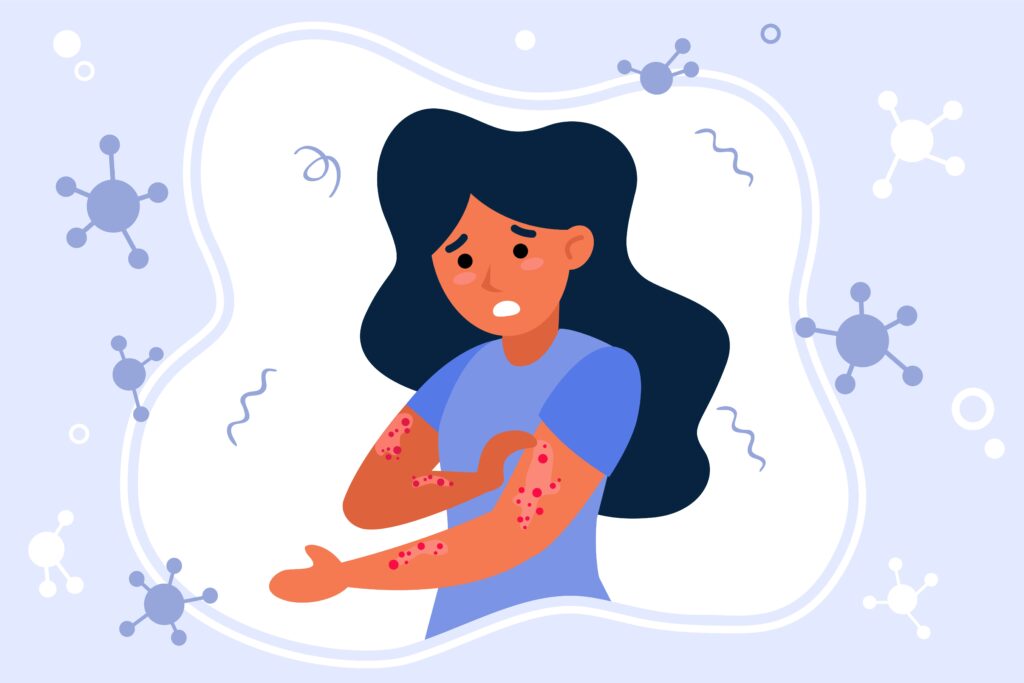 complications virus monkeypox