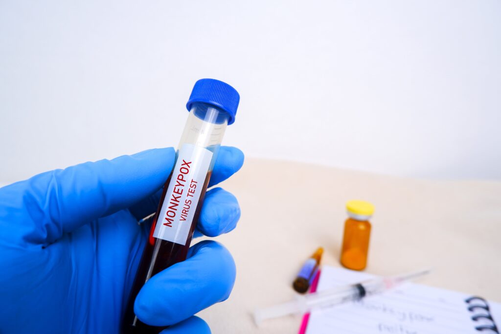 monkeypox test