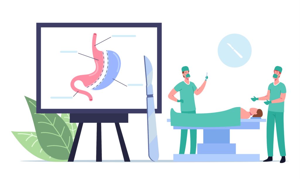 bariatric surgery