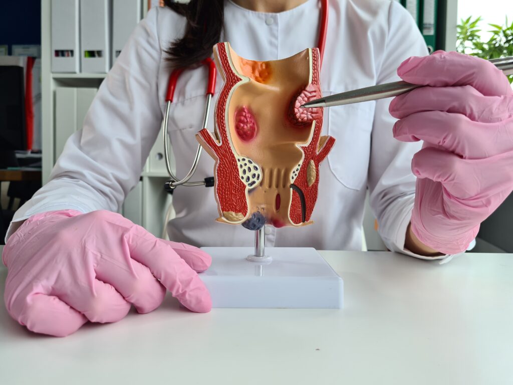 treatment of hemorrhoids in proctology