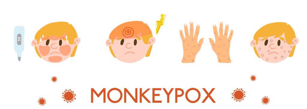 symptômes de la variole du singe