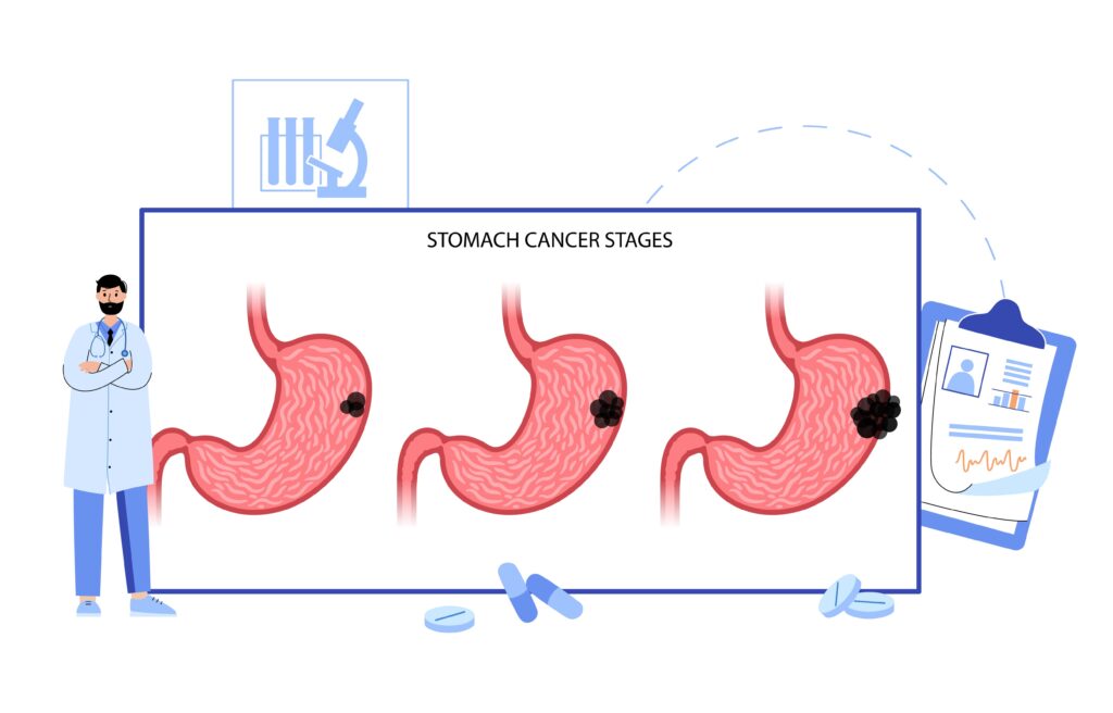 cancer estomac cause melena