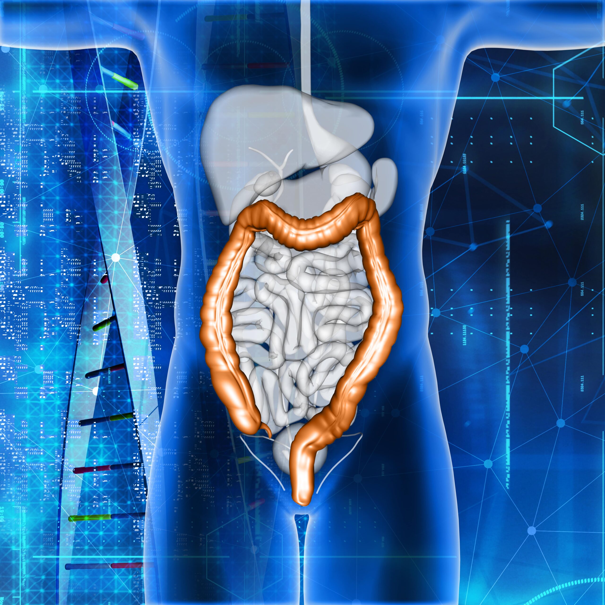 maladie de Crohn