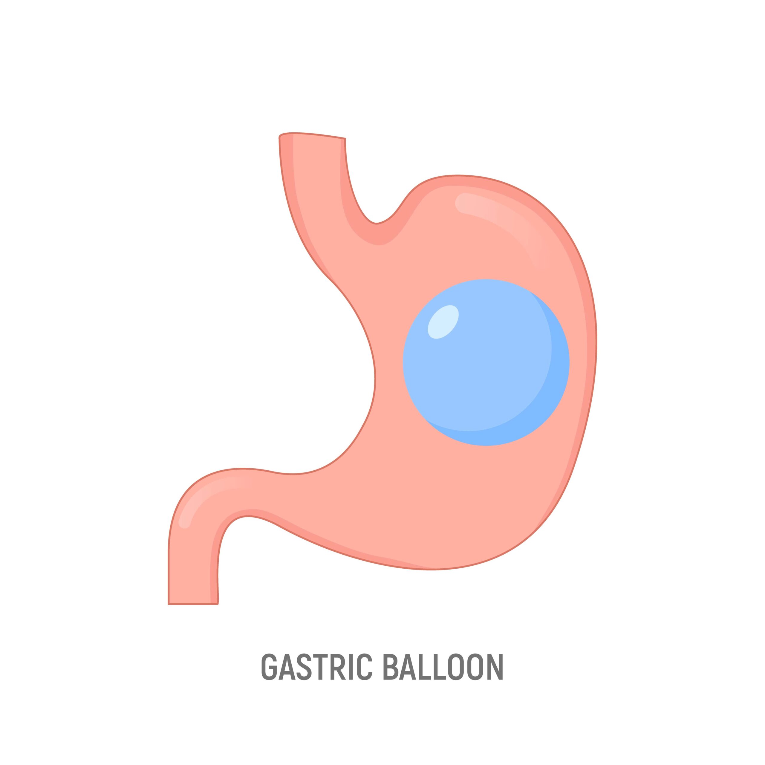 ballon gastrique