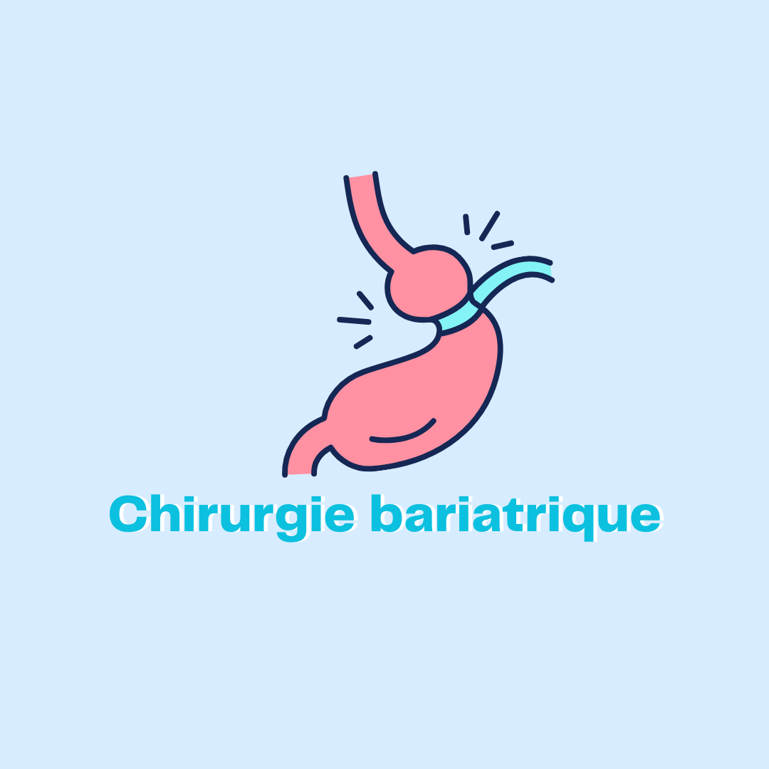 chirurgie bariatrique