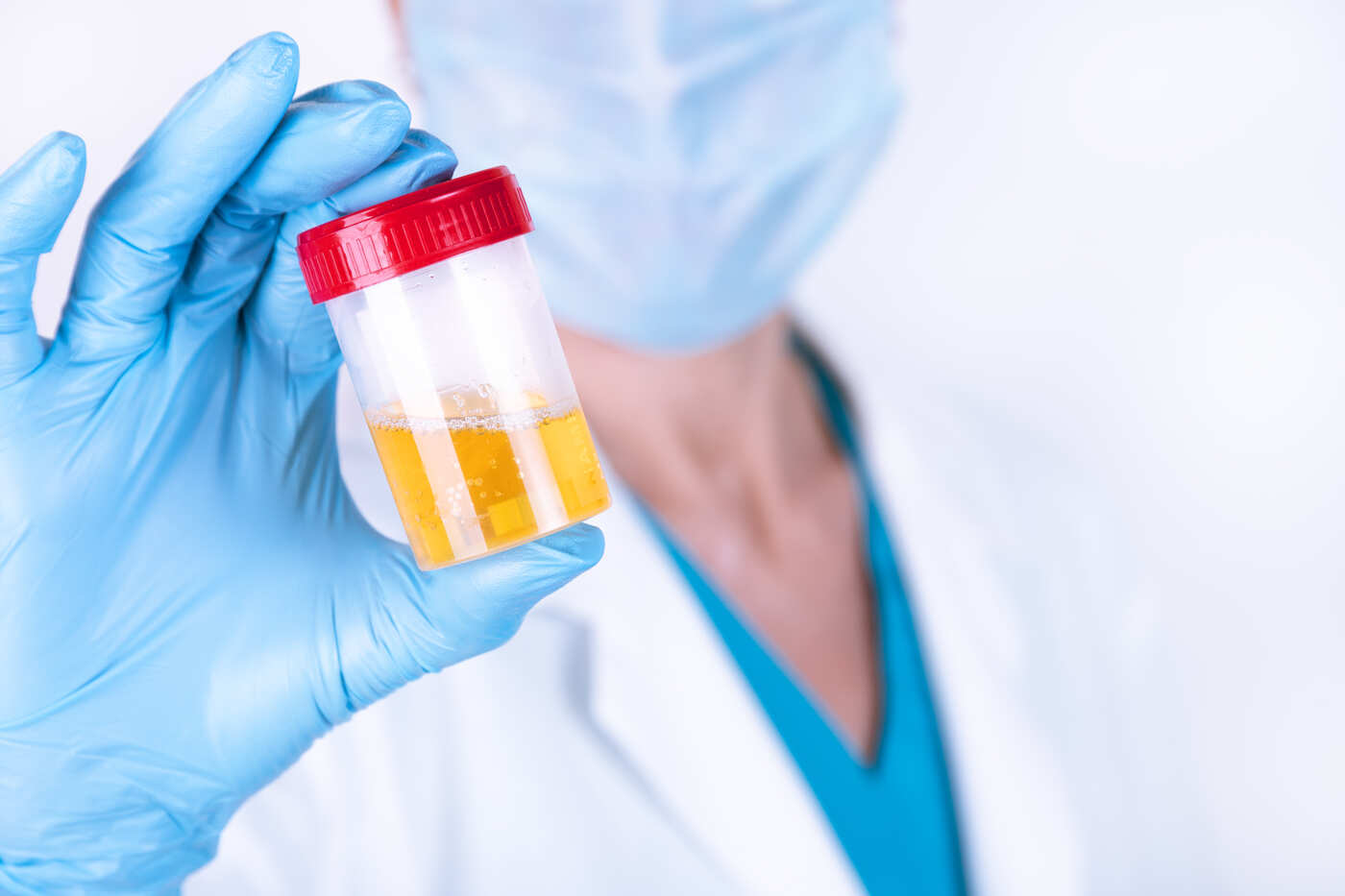 test urine qui sent fort