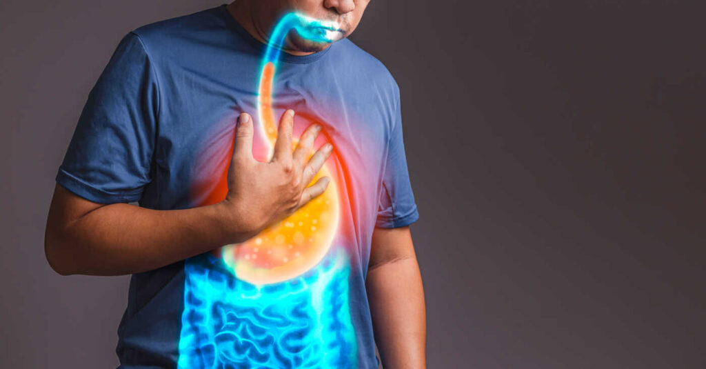 reflux gastro-œsophagien œsophage de Barrett 