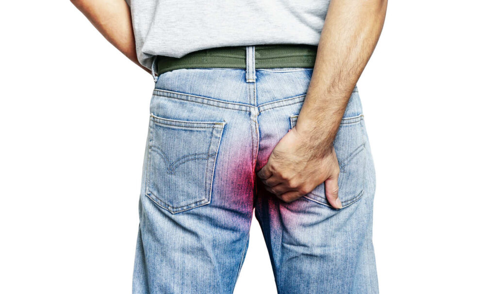 saignement fistule anale