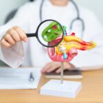 ablation de la vésicule biliaire