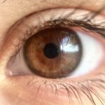 rétinopathie diabétique
